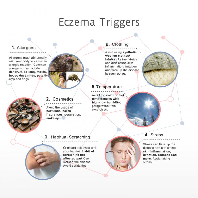 Interesting Facts About Atopic Dermatitis Eczema Infographic