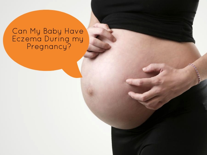 Eczema During Pregnancy >> Eczema During Pregnancy Are They Inter Related Eczema During Pregnancy >> Eczema During Pregnancy Are They Inter Related