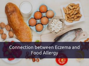 eczema and food allergies