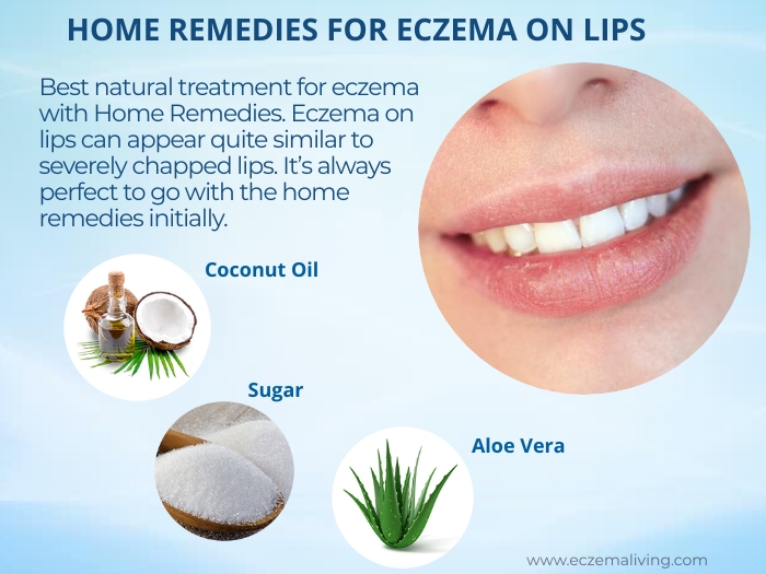 eczema-on-lips-causes-treatment-home-remedies