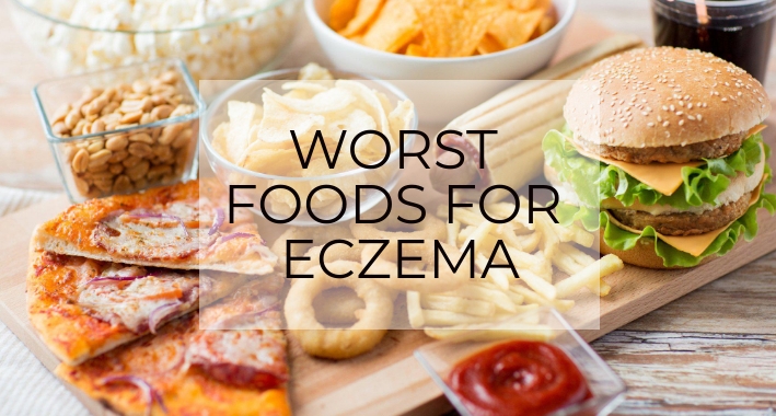 Food Triggers Eczema Foods To Avoid To Get Rid Of Eczema 