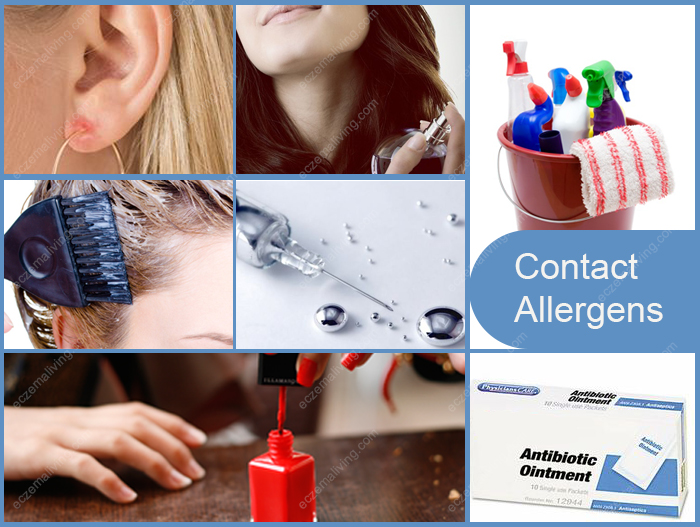 Allergic Contact Dermatitis - Types, Causes & Treatments