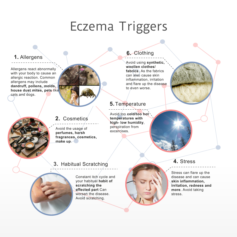 8 Most Common Eczema Triggers in 2019 – An INFOGRAPHIC