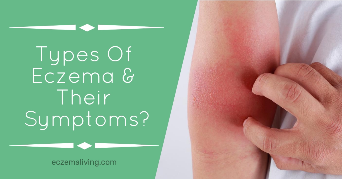 What Are The Various Types Of Eczema & Their Symptoms?