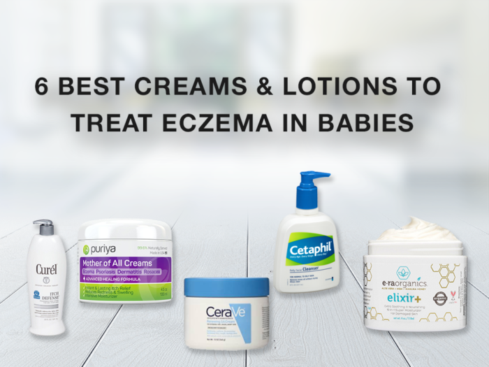 6 Best Creams & Lotions to Treat Eczema In Babies?