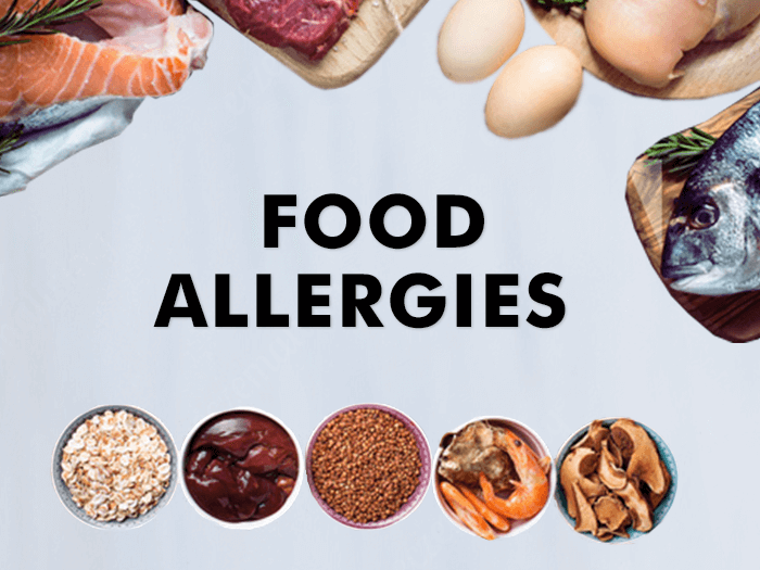 What is a Food Allergy? – Types, Causes, Symptoms & Treatments