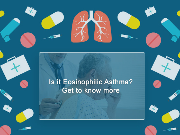 What Is Eosinophilic Asthma? Diagnosis, Symptoms & Treatment