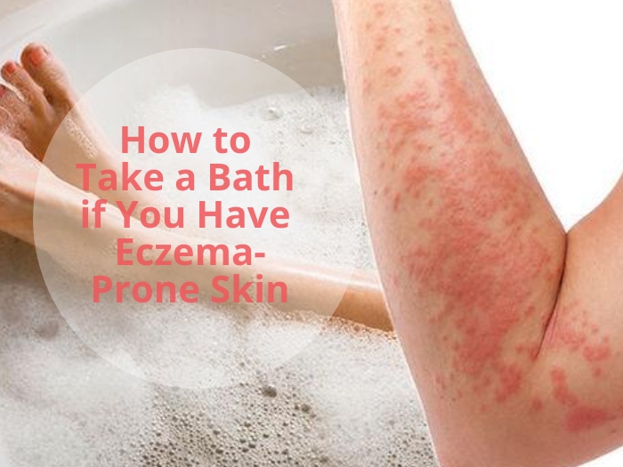 eczema bath - eczema bath soak