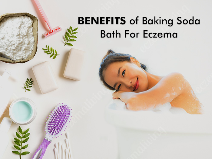 Baking Soda For Eczema – Bath Treatment and Benefits