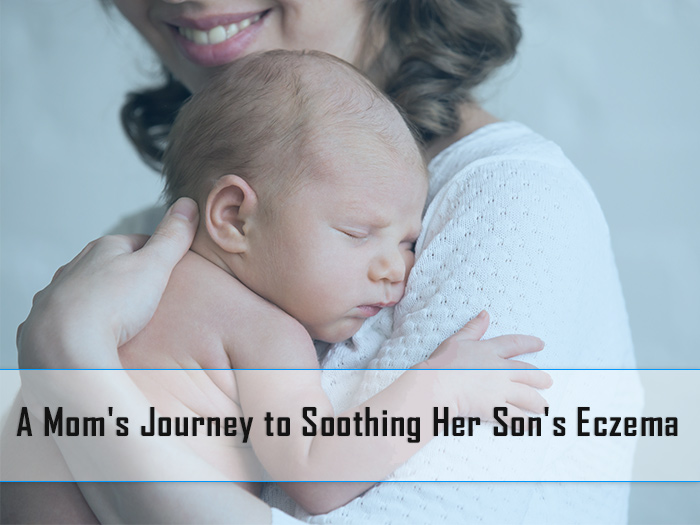 A Mother’s Story About Her Child With Severe Eczema