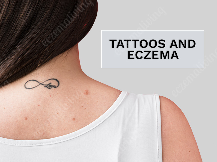 Tattoos And Eczema Skin – Risks Involved & Self Care Tips
